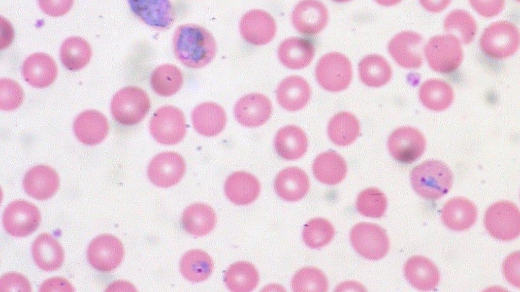 Researchers trained a deep learning model to identify malaria parasites